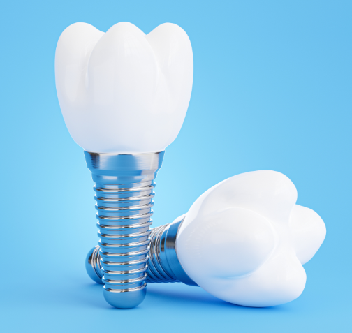 Dental implants